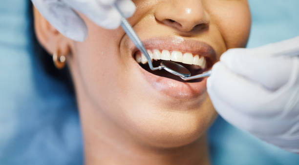 Best Chipped Tooth Repair Near Me  in Warren, OR